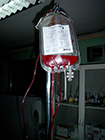 Puna krv